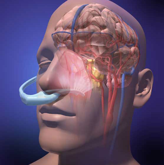 A portable up-the-nose cooling device that lowers body temperature and prevents brain damage Linda Visualizing Nature