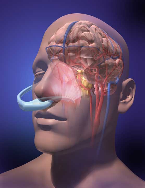 A portable up-the-nose cooling device that lowers body temperature and prevents brain damage Linda Visualizing Nature