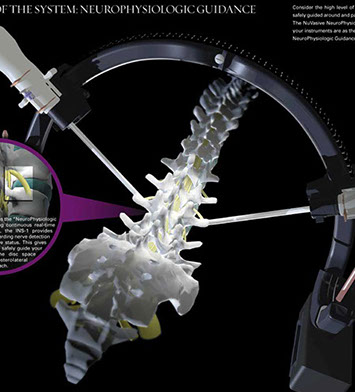 Maximum access technique for a lateral retroperitoneal approach for reconstructive spinal surgery. Linda Nye Visualizing Nature
