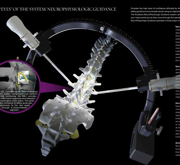 Maximum access technique for a lateral retroperitoneal approach for reconstructive spinal surgery. Linda Nye Visualizing Nature