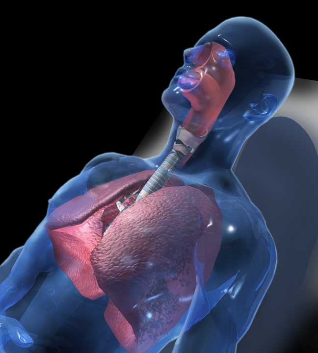 3D model illustration for a brochure on sleep apena and sleep therapies.