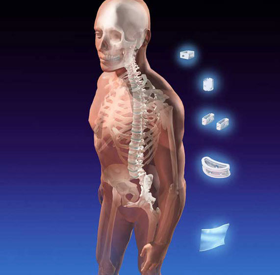 Annual report illustration of bioresorbalbe spine and orthopedic implants. Linda Nye Visualizing Nature