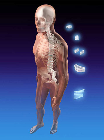 Annual report illustration of bioresorbalbe spine and orthopedic implants. Linda Nye Visualizing Nature